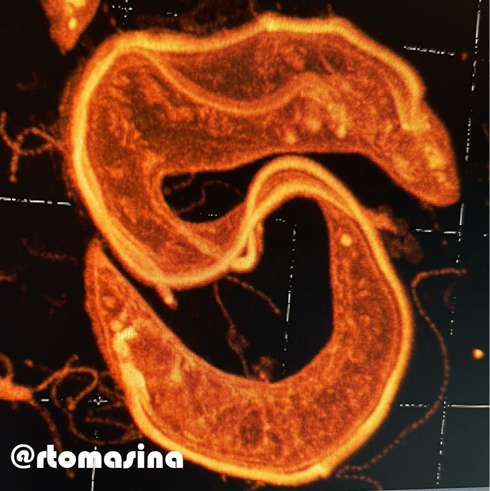 Trypanosoma evansi expansion microscopy