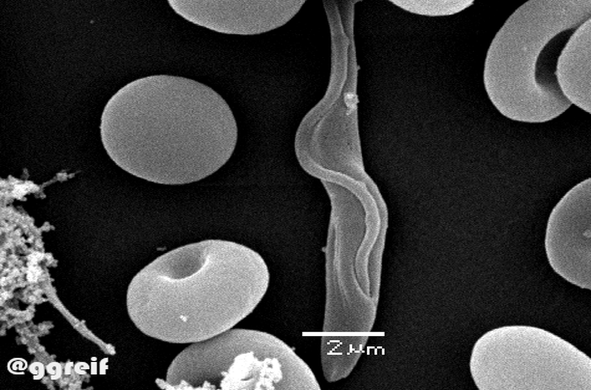 Trypanosoma vivax blood for Electron microscopy